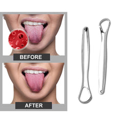Stainless Steel Tongue Cleaner Scraper (2-Pack or 4-Pack) – Oral Hygiene Tongue Scraper for Fresh Breath & Daily Tongue Cleaning
