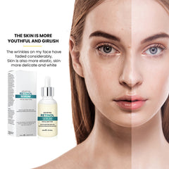2.5% Retinol Face Serum with Hyaluronic Acid & Vitamin E – Nighttime Facial Serum for Fine Lines, Uneven Skin Tone & Hydration, Anti-Aging Skincare for Women & Men