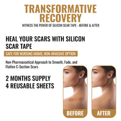 Scar Away Silicone Scar Sheets Tape (5.9"x 1.6”) Removal for Surgical, Keloid, C-Section, Acne Burns & Tummy Tuck Scars (4 Sheets)
